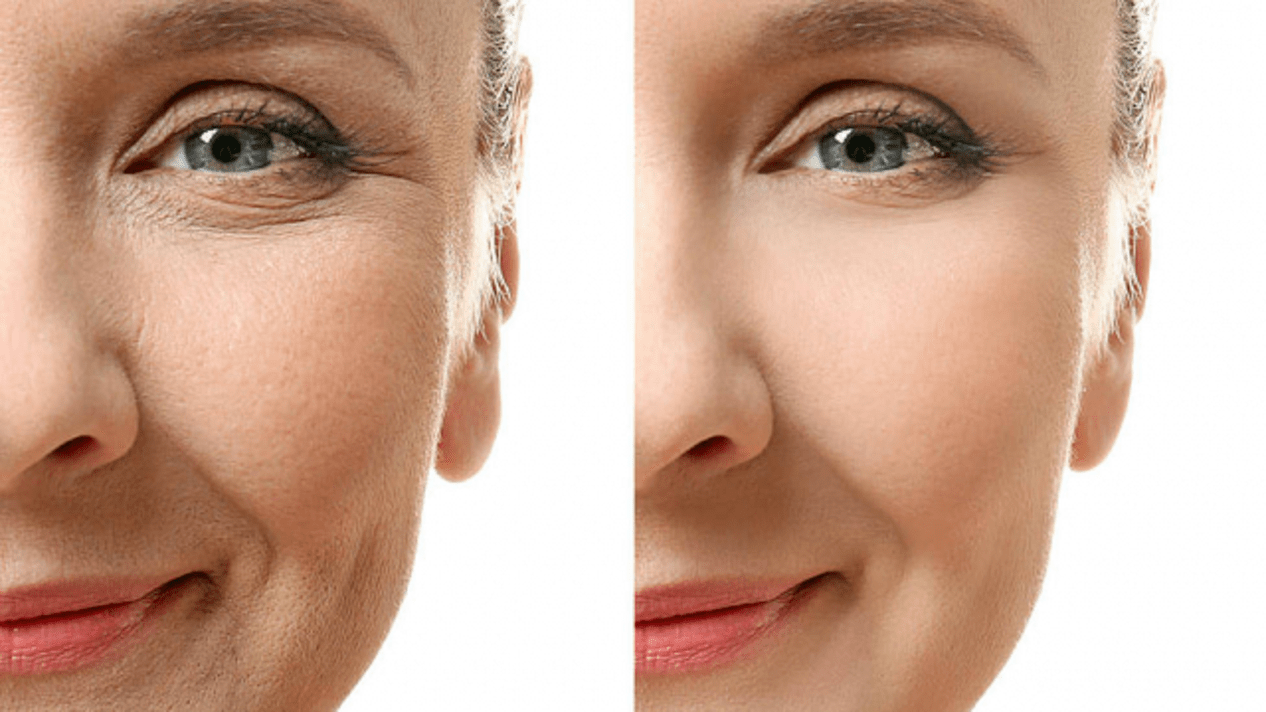 Die Wirkung der Verwendung des Simpla 360-Serums bei alternder Haut